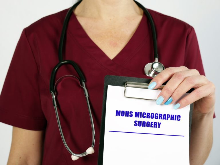 When Should You See a Mohs Surgeon in Bethesda, Maryland?