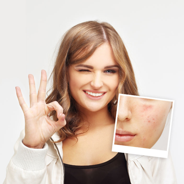 acne treatment dermatologist chevy chase
