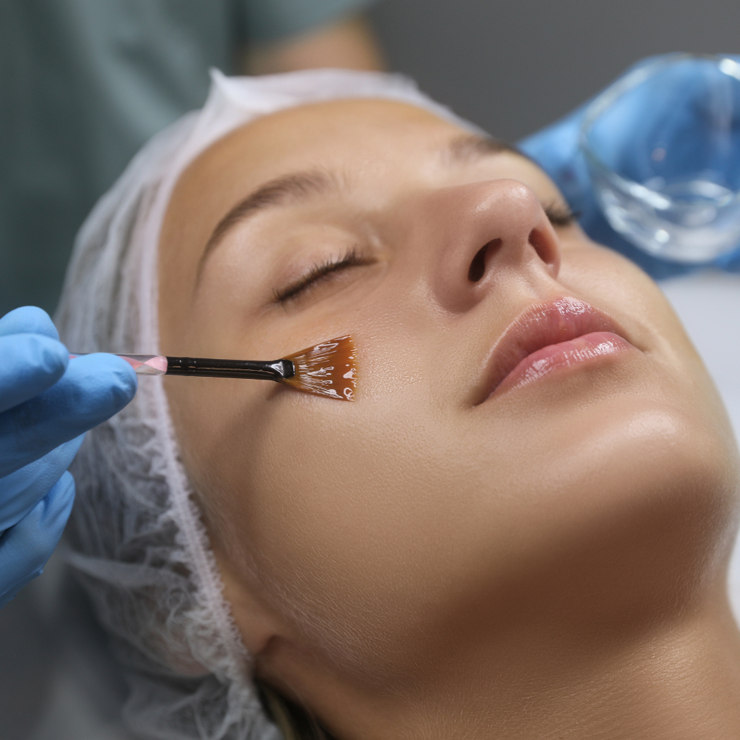 chemical peel cost chevy chase