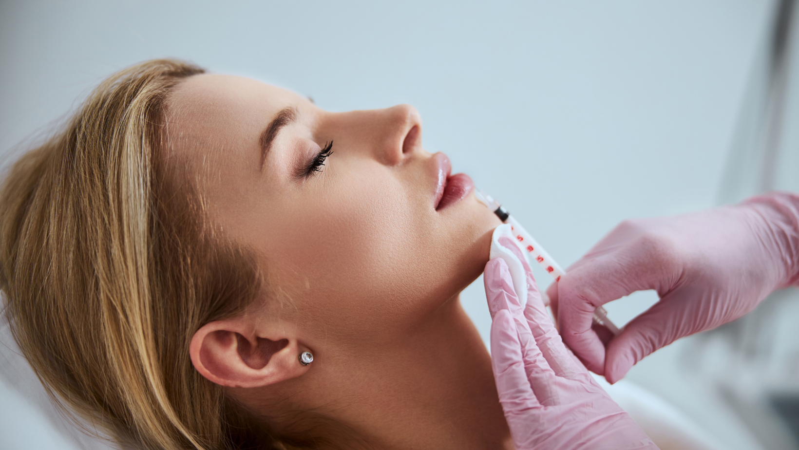 Guide to Juvéderm Fillers in Chevy Chase