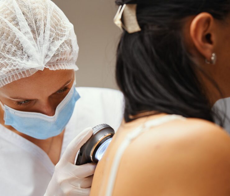 Mohs Surgeon Denton- Effective Treatment for Skin Cancer