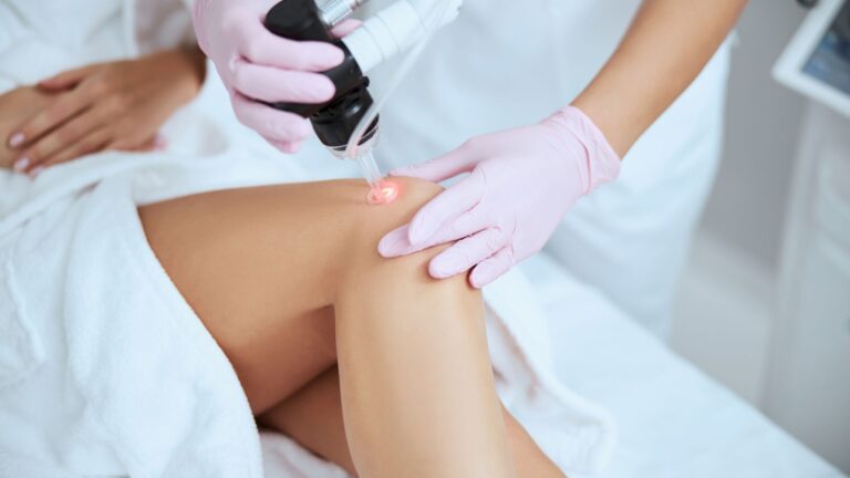 Sclerotherapy For Spider Veins Easton