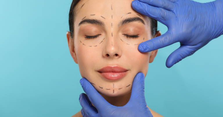 Profound Facelift Chevy Chase