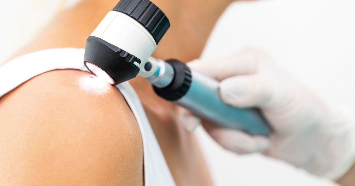 Skin Cancer Specialist in Easton