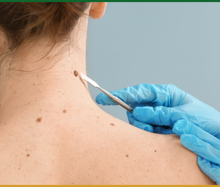 Delaware Skin Cancer Specialist