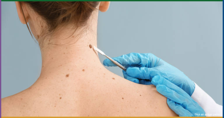 Delaware Skin Cancer Specialist