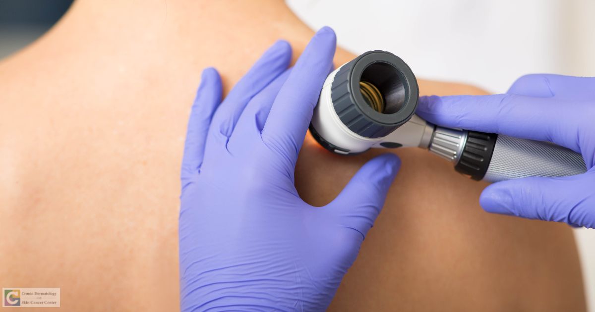 medical dermatologist near delaware