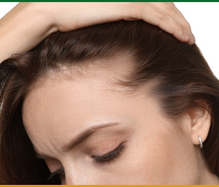 hair loss specialist Maryland