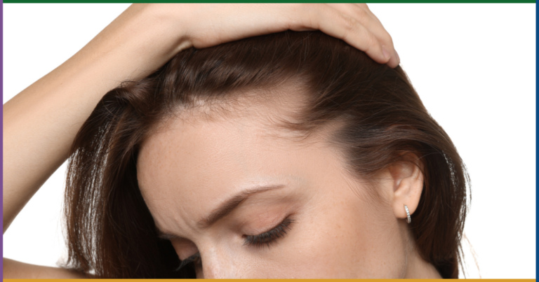 hair loss specialist Maryland